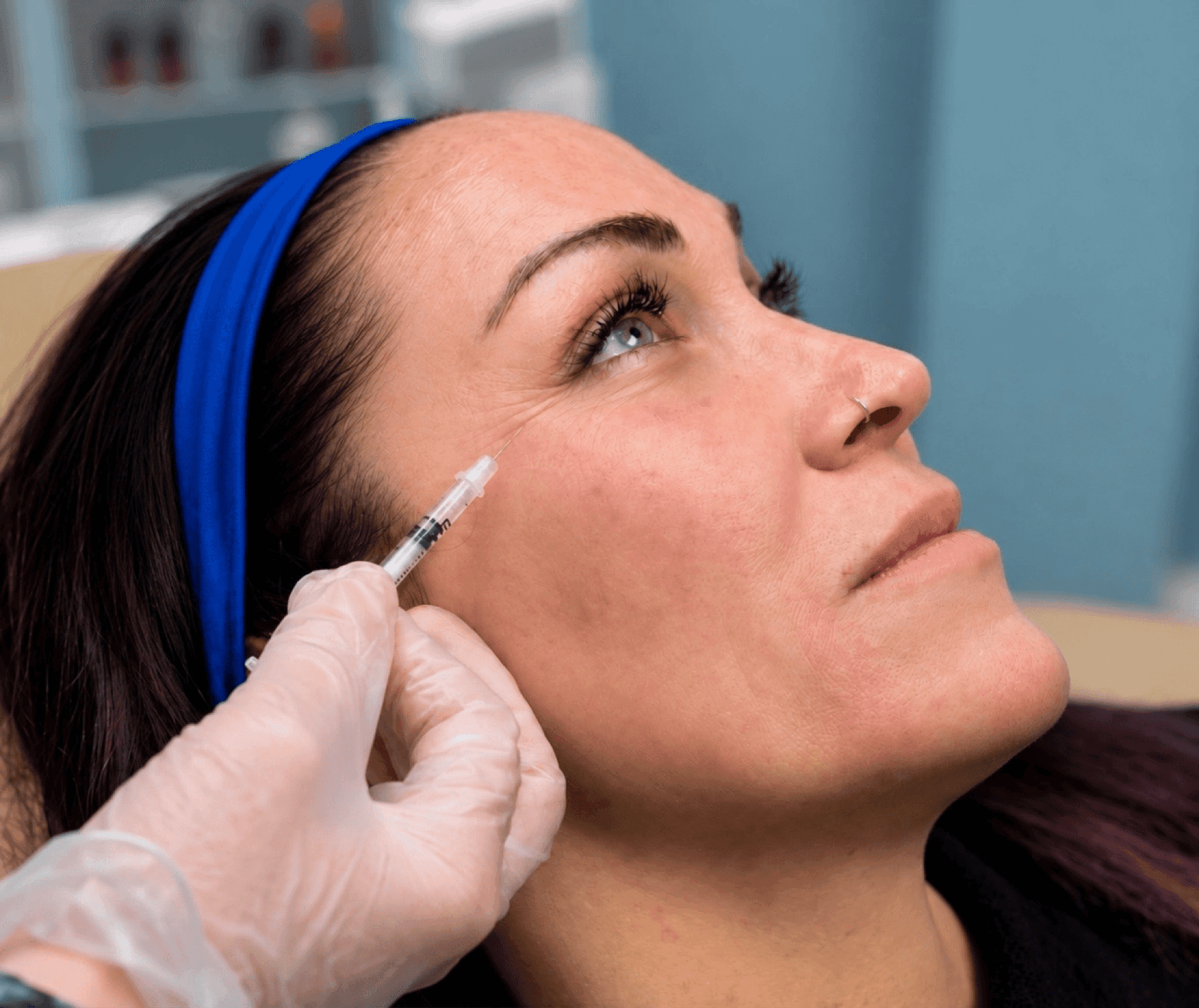SmoothGLO — tox injection treatment